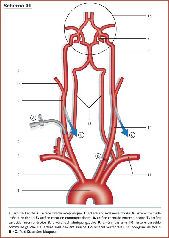 Fig.1