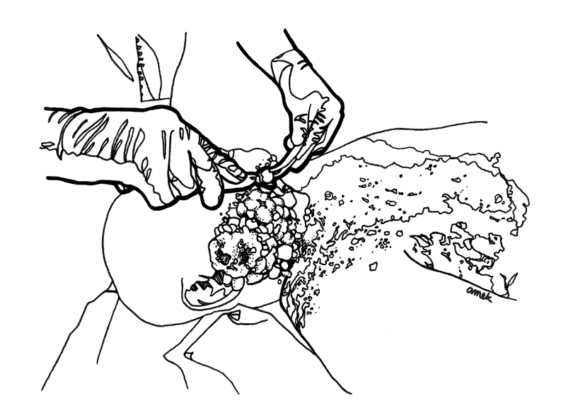 AMEK facial tumor removal illustration 1